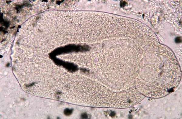 Взрослый дигенетический сосальщик Diplostomum spathaceum, фото фотография паразиты рыб