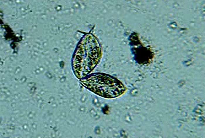 Парамеция (Paramecium aurelia), фото фотография