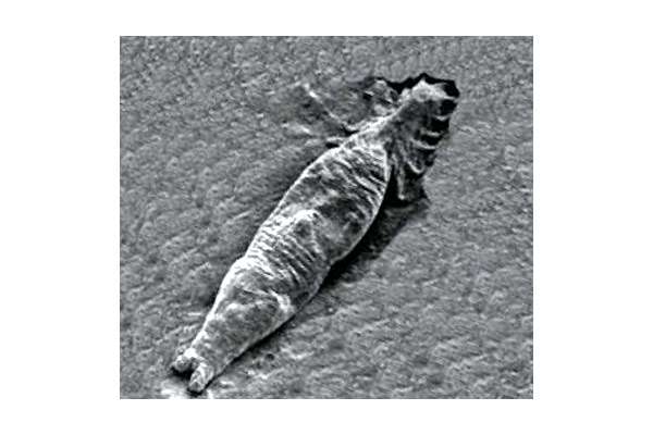 Моногенетический сосальщик гиродактилюс (Gyrodactylus salaris), фото фотография болезни рыб