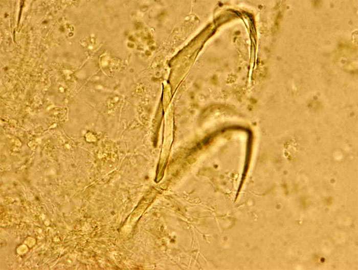 Сосальщик дактилогирус (Dactylogyrus baueri), фото фотография болезни рыб