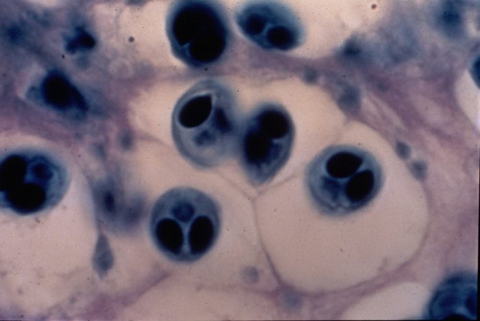 Myxobolus cerebralis (Myxozoa), споры в тканях рыбы, фото фотография