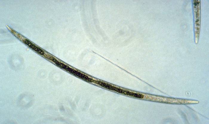 Корневая галловая нематода (Subanguina picridis), фото фотография черви