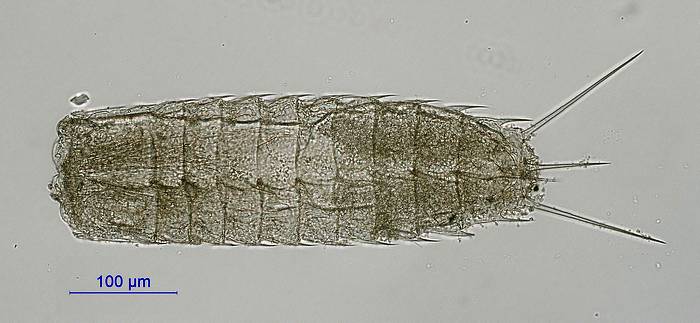 Головохоботный червь Paracentrophyes quadridentatus, фото фотография беспозвоночные