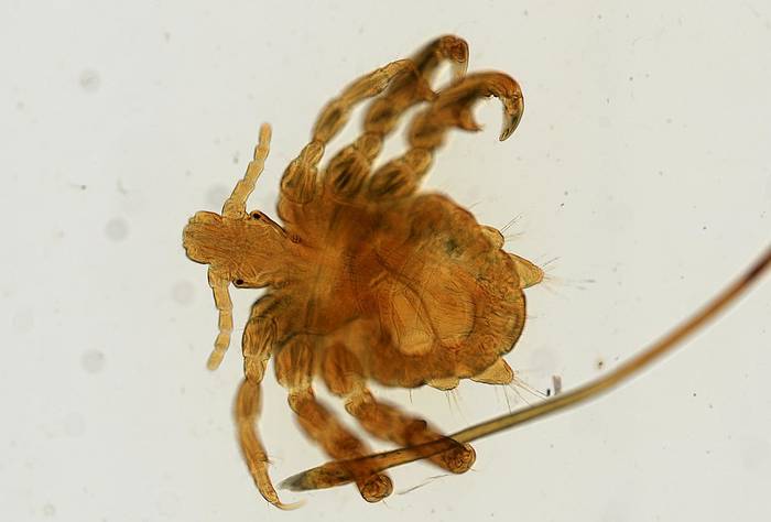Лобковая вошь (Phthirus pubis), фото фотография власоеды